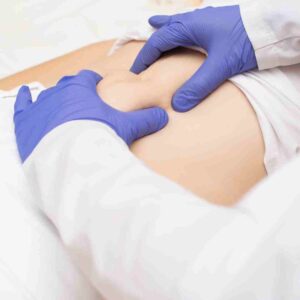 can pilates cause hernia